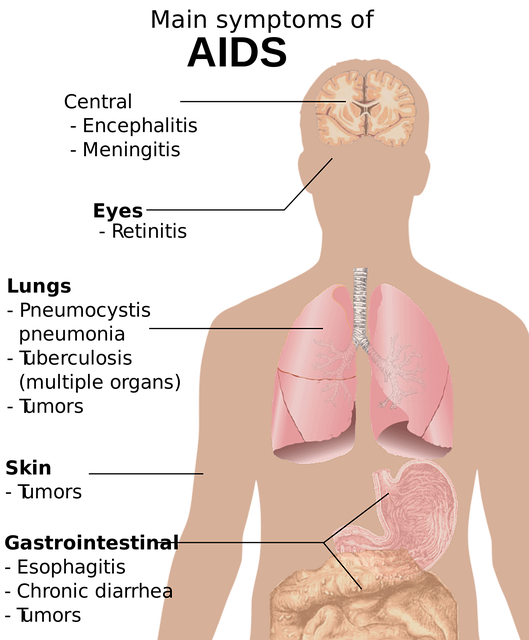 Infection Symptoms