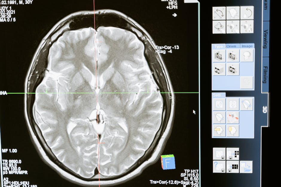 Brain Stimulation