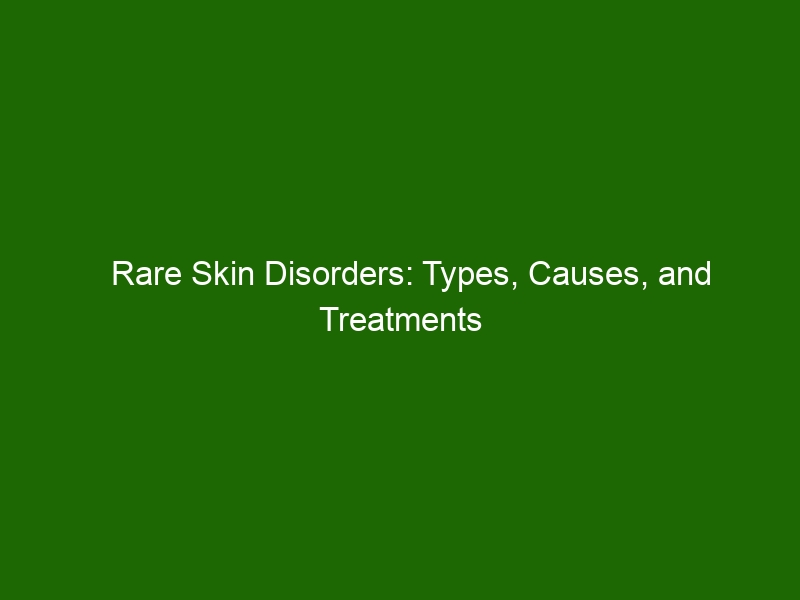 Rare Skin Disorders Types Causes And Treatments Health And Beauty