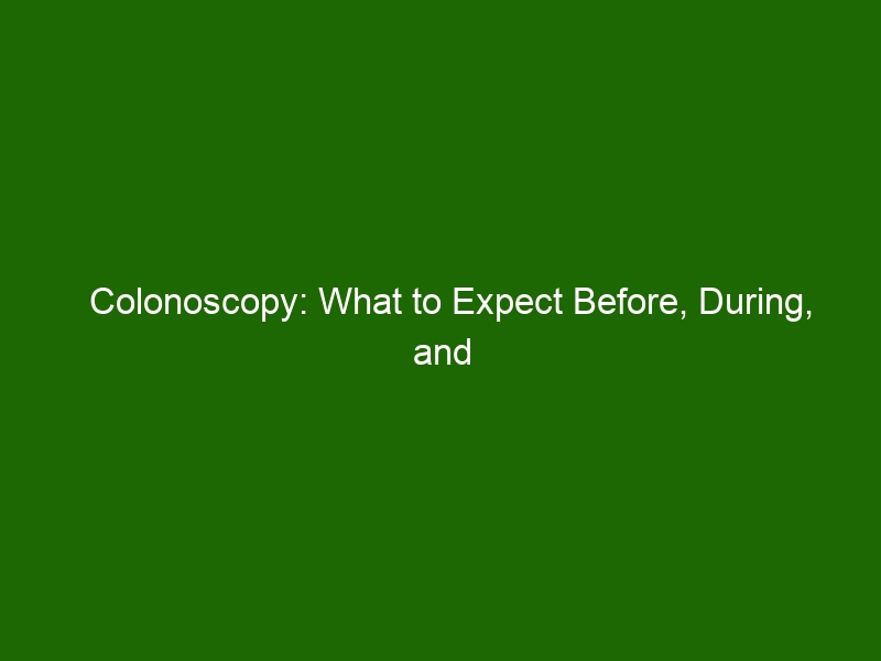 Colonoscopy: What to Expect Before, During, and After Your Procedure
